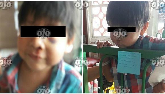 VMT: niño de 3 años es golpeado brutalmente por trabajador de la comuna (FOTOS)