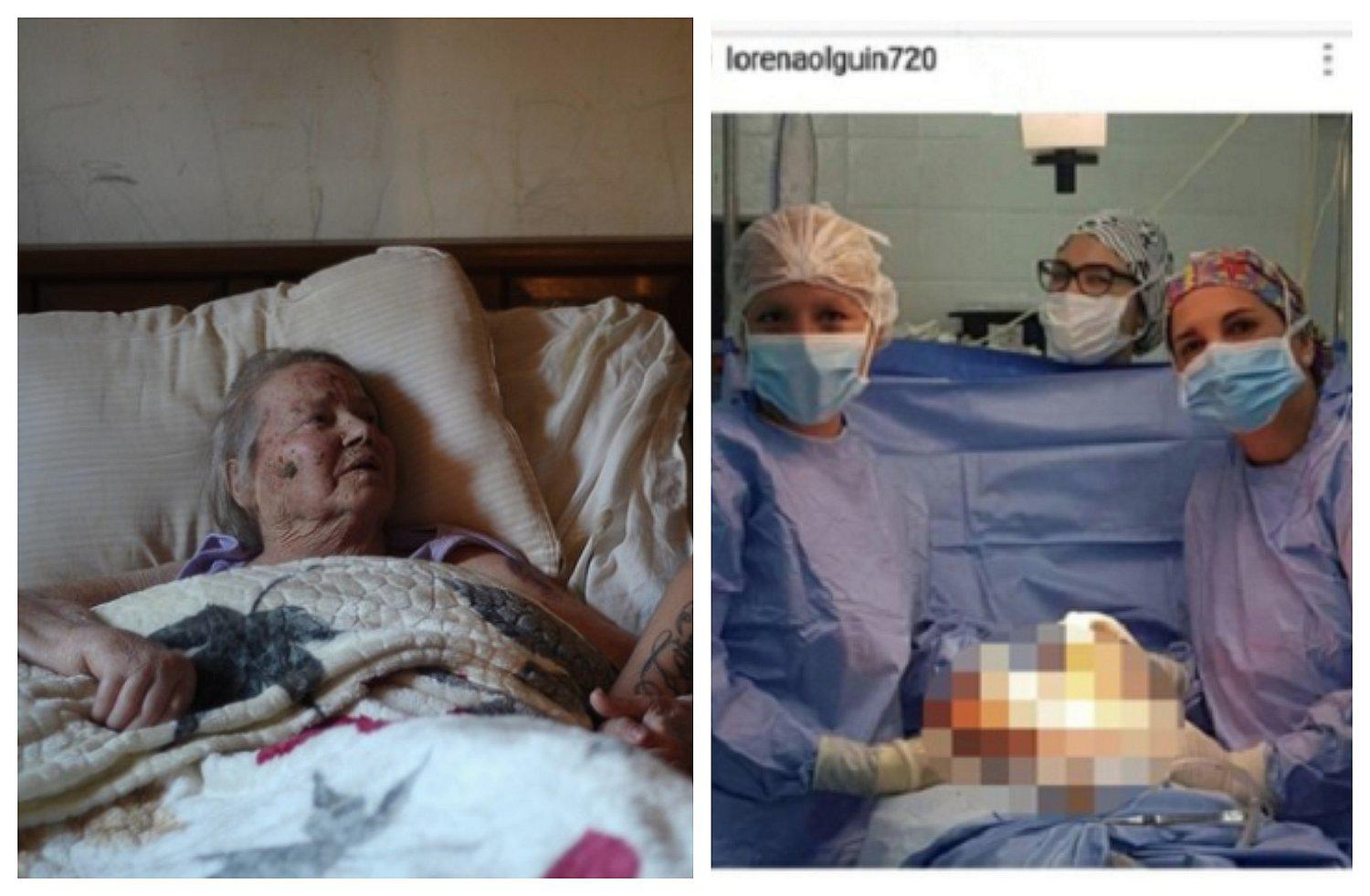Anciana reclama disculpas de médicos que se tomaron selfies mientras la operaban (FOTO)