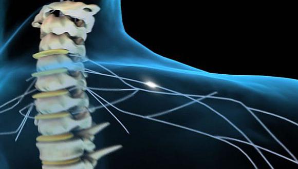 Nanosonda podría rehabilitar a pacientes con daño en la médula espinal