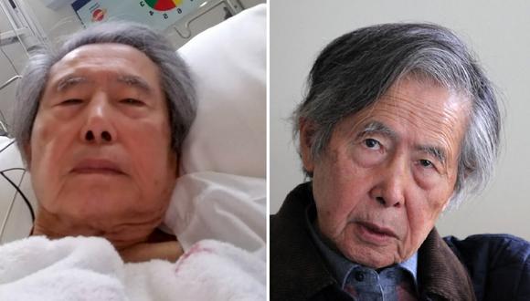 Alberto Fujimori sigue hospitalizado: “Él ya quiere irse, no es un buen paciente”, afirma su médico | AFP