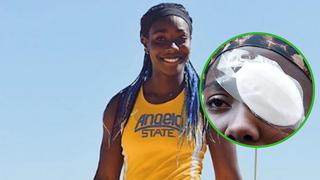 Le tiran huevazos en ojo de atleta nigeriana y tuvo que ser operada de emergencia