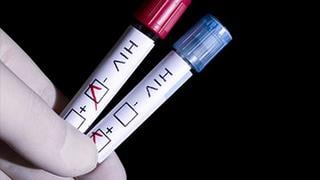 Denuncian a empresas por pedir pruebas de VIH a sus empleados 