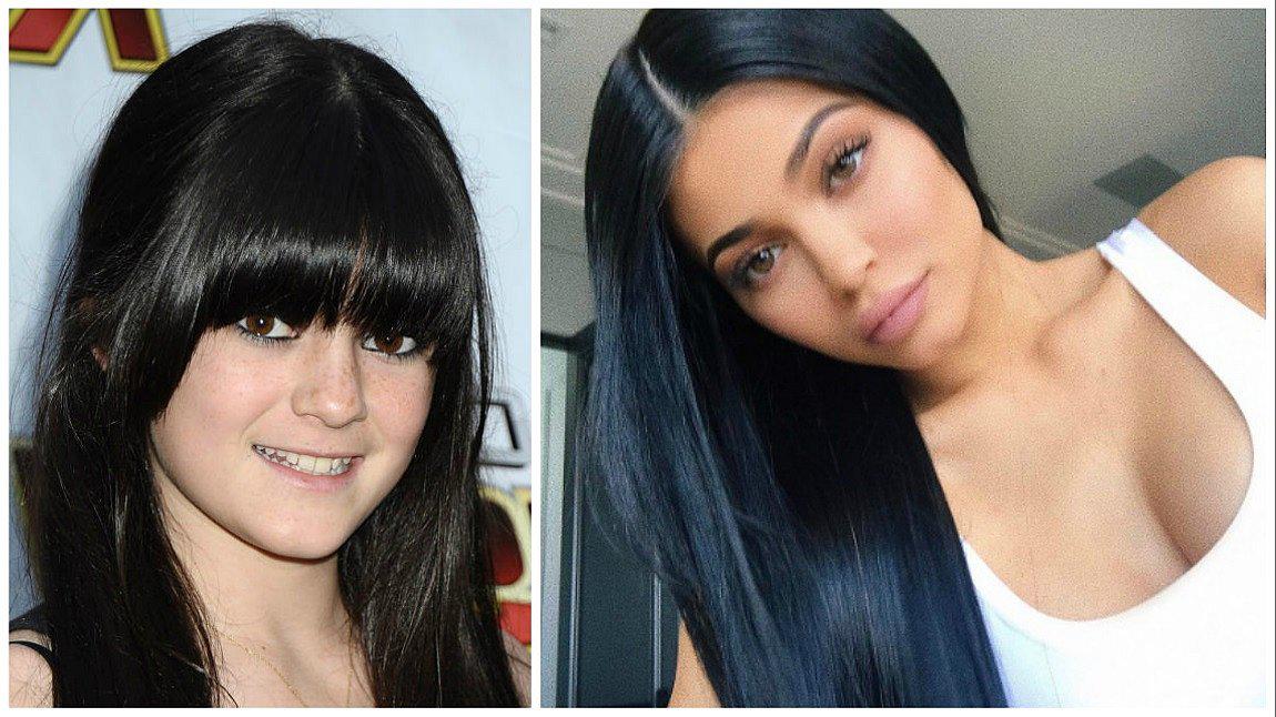 ¿Kylie Jenner eres tú? Así fue la metamorfosis de la menor de las Kardashian