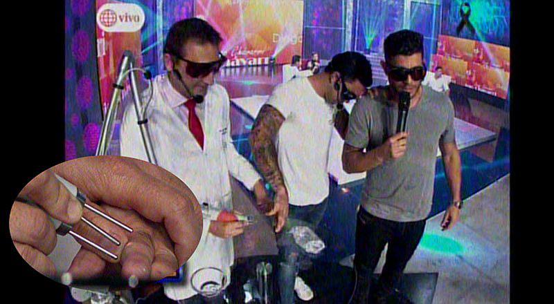 Diego Chávarri grita de dolor al borrarse tatuaje con nombre de Melissa Klug 