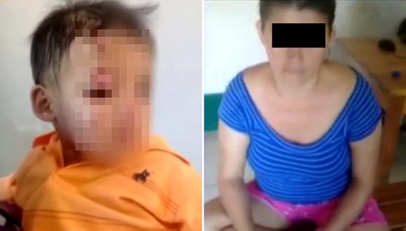 Niño de 4 años podría perder la vista tras ser golpeado brutalmente por su madre (VIDEO)