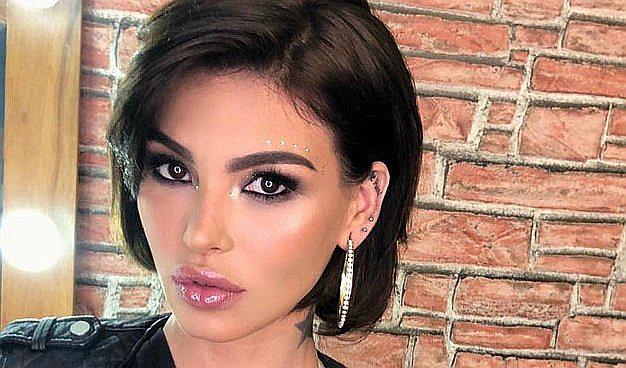 Angie Jibaja aparece con ojo morado y aún no se esclarece el motivo 