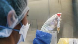 Perú crea prueba molecular para el diagnóstico del COVID-19 que da resultados en menos de 1 hora