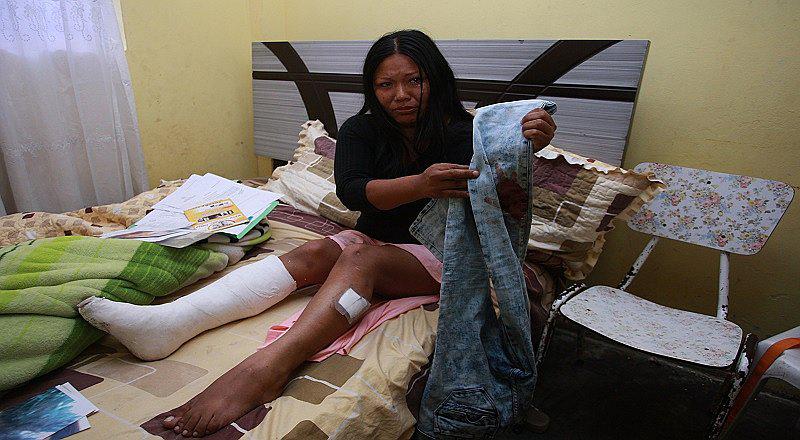 Los Olivos: Sujeto le genera brutal agresión a su ex y sigue libre 