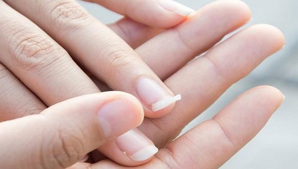¿Se te rompen las uñas de las manos con facilidad? 6 consejos para evitarlo