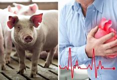 Corazones de cerdos podrían ser trasplantados a humanos en 3 años, según experto cirujano 