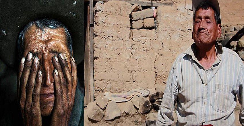 Parán, el pueblo destinado a la ceguera sin saber por qué 