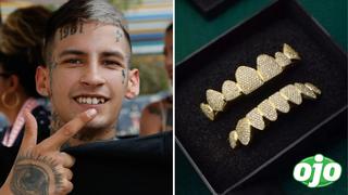 L-Gante presume su nueva dentadura postiza hecha de oro y diamantes