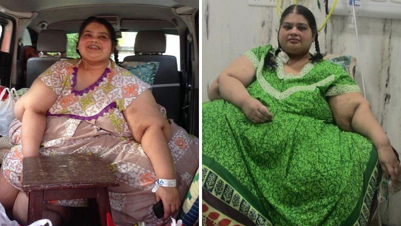 Mujer que pesaba 300 kilos logra gran transformación (FOTOS)
