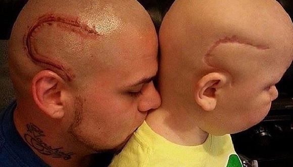 ¡Papá se tatúa la misma cicatriz que tiene su hijo con cáncer! [FOTO]