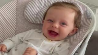 La bebé que se está convirtiendo en “piedra” nunca deja de sonreír a pesar de su enfermedad