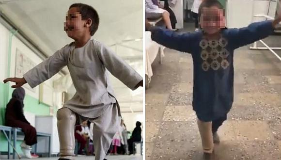 El enternecedor baile de un niño víctima de la guerra tras recibir una "nueva pierna" (VIDEO)