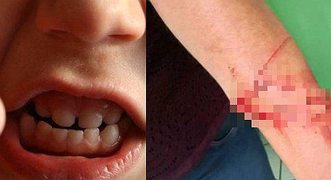 Niño agrede a su profesora con cuchillo por no dejarlo ir al baño