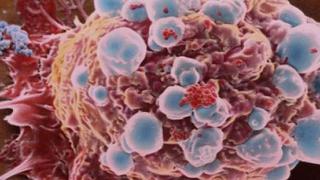 Prueban en ratones "dejar morir de hambre" a las células cancerígenas 