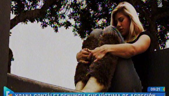 Xoana González denunció que fue salvajemente golpeada por su ex pareja [VIDEO] 
