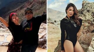 Ex candidata al Miss Perú acusó a su pareja de haberle roto la clavícula (FOTOS)