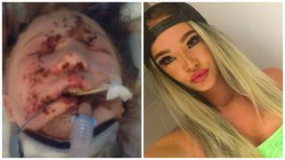  Facebook: La sorprendente transformación de una joven que tenía el rostro desfigurado [FOTOS]