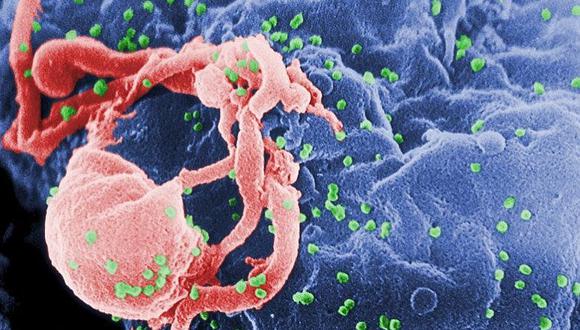 Un estudio revela cómo el virus del VIH infecta a las células sanas 