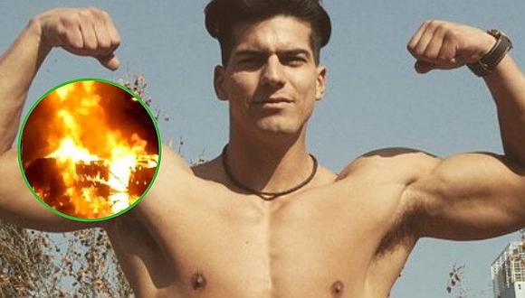 El rostro de Ignacio Lastra a un año de quemarse el 90% de su cuerpo (FOTO)