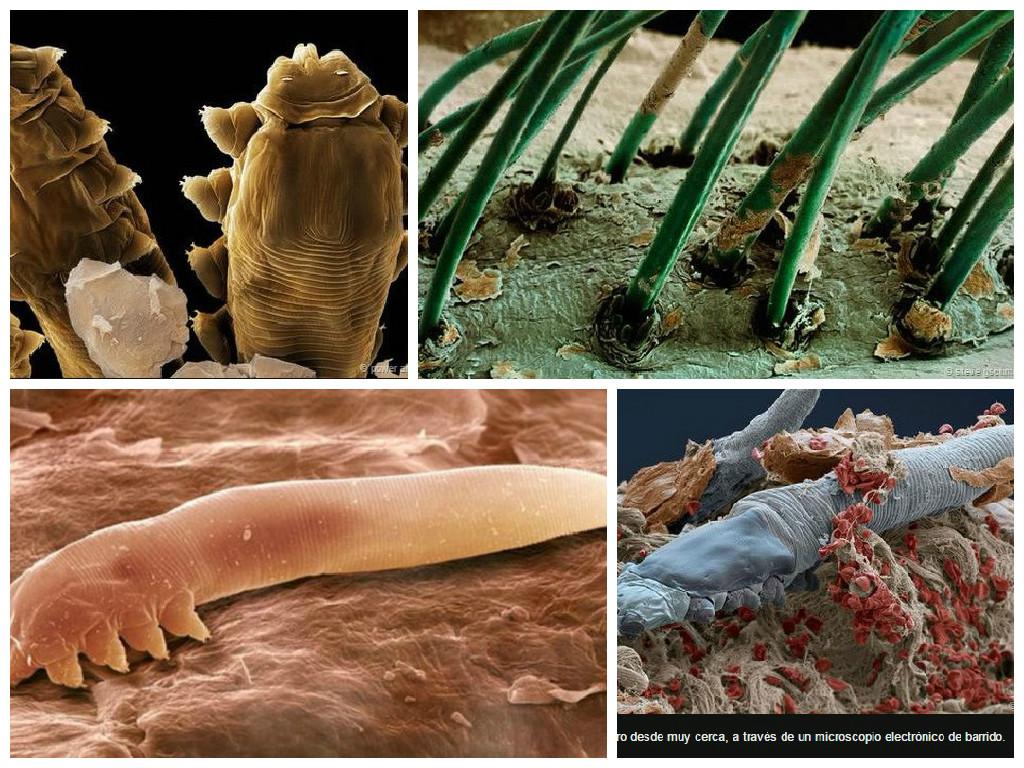 ¿Sabías que existen ácaros microscópicos que viven en nuestro rostro?