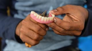 Perdió la dentadura en 2011 en España y se la enviaron a su casa en Inglaterra 11 años después