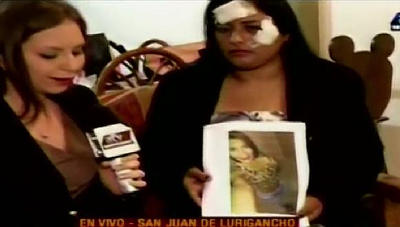 Venezolanos en Perú: mujer denuncia a llanera de desfigurarle el rostro (VIDEO)