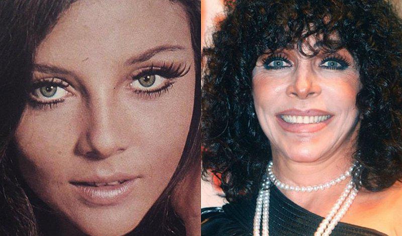 8 cirugías que cambiaron el físico de Verónica Castro