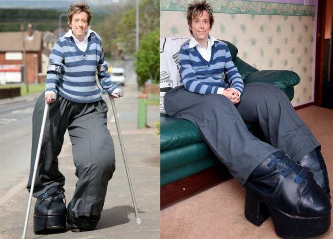 Mujer con piernas más grandes del mundo vive drama