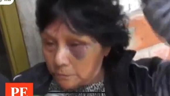 San Martín: Tres delincuentes golpean sin piedad a anciana por sus ahorros