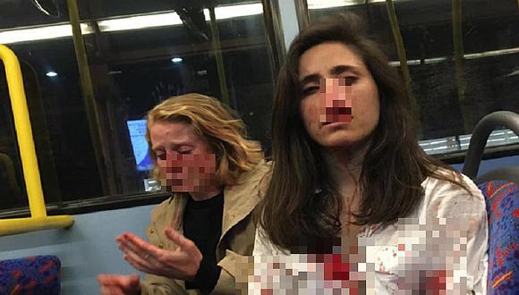 Pareja de lesbianas son golpeadas por cuatro hombres dentro de bus en Londres 