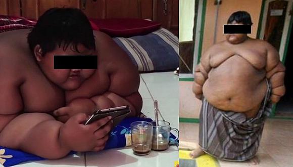Obesidad mórbida: Conoce el caso de un niño de 10 años que pesa 192 kilos 
