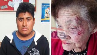 ​Anciana es brutalmente golpeada por cobrador al pedir 20 céntimos de vuelto (FOTOS)