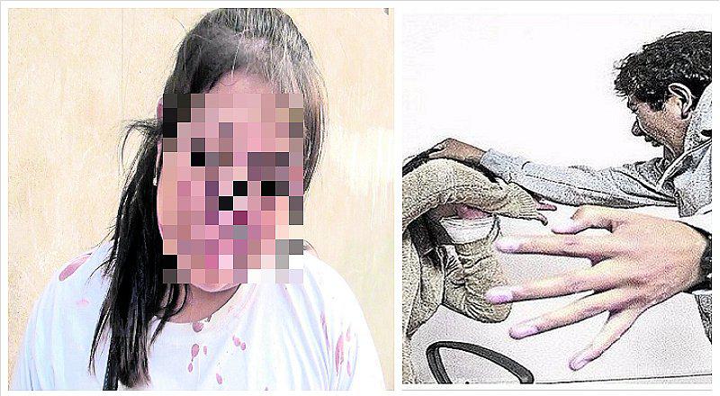 Mujer es golpeada por cuarta vez por su expareja pese a que lo denunció en Chosica 