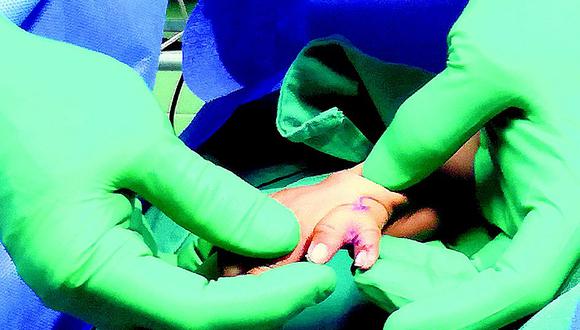 ​Hospital del Niño: operarán gratis a menores con deformaciones en las manos