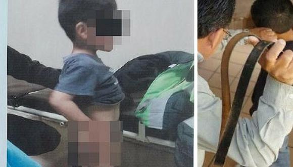 Padrastro golpea a su hijastro de cuatro años hasta fracturarle el brazo