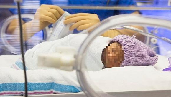 Bebé muere por culpa de incubadora: terminó con quemaduras de tercer grado