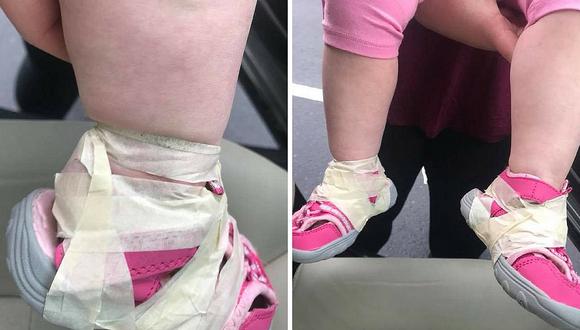 Pies de niña son envueltos con cinta para evitar que se quite los zapatos (FOTOS)