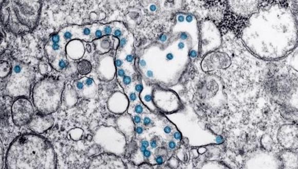 Partículas del virus SARS-CoV-2, coloreadas en azul, en una imagen de microscopio de electrones. Imagen facilitada por el Consejo Superior de Investigaciones Científicas. (Foto: EFE)