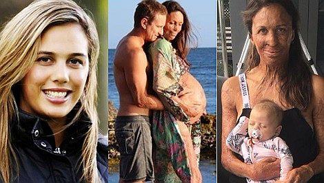 Luego de someterse a más 200 operaciones, Turia Pitt dio a luz a su primer hijo 