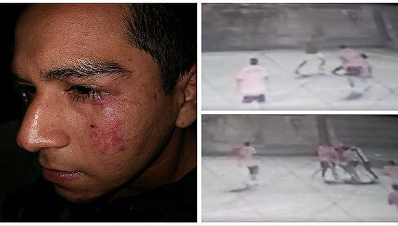Surquillo: jugador recibe brutal patada en el rostro tras resbalarse durante partido (VIDEO)
