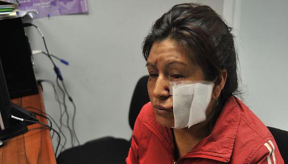 Mujer recibe cortes en el rostro por parte de su ex pareja en Independencia 