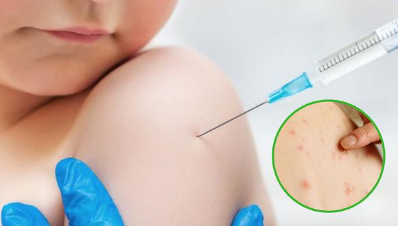 Con OJO crítico: Es preciso vacunarse