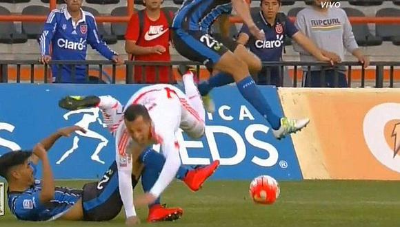 Futbolista chileno sufre aterradora fractura durante partido [VIDEO]