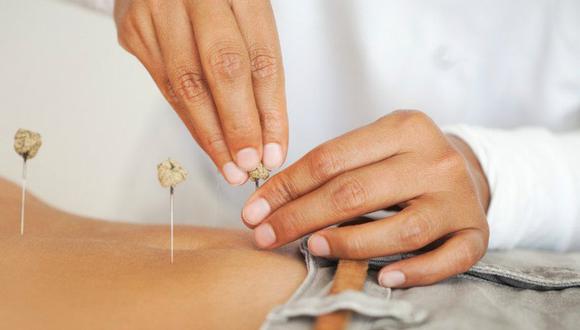 ¡Cómo! ¿La acupuntura ayuda a incrementar la fertilidad?