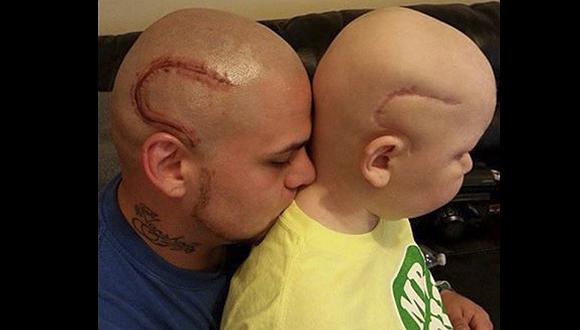 Padre que se tatuó la cicatriz de su hijo con cáncer recibió la noticia más triste