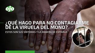 Viruela del mono en el Perú: ¿Cómo evito contagiarme de esta extraña enfermedad?